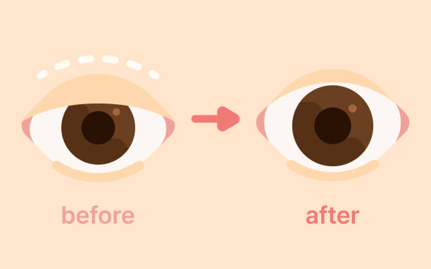 Glaucoma Specialist Aizawl